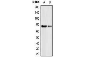 Western blot analysis of GUCY1B2 expression in HL60 (A), Jurkat (B) whole cell lysates.