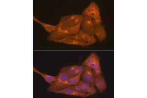 Immunofluorescence analysis of U2OS cells using RARα Rabbit pAb (ABIN6128615, ABIN6146692, ABIN6146695 and ABIN6213825) at dilution of 1:100 (40x lens). (Retinoic Acid Receptor alpha antibody  (AA 1-457))