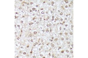 Immunohistochemistry (IHC) image for anti-C-Abl Oncogene 1, Non-Receptor tyrosine Kinase (ABL1) (pTyr412) antibody (ABIN7265966)