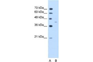 WB Suggested Anti-GNAS Antibody Titration:  2.