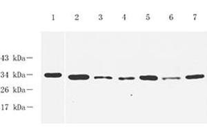 Western blot analysis of GTF2F2,(ABIN7074036) at dilution of 1: 1000,Lane 1: PC3 cell lysate,Lane 2: Mouse spleen tissue lysate,Lane 3: Mouse lung tissue lysate,Lane 4: Mouse testis tissue lysate,Lane 5: Rat spleen tissue lysate,Lane 6: Rat lung tissue lysate,Lane 7: Rat testis tissue lysate (GTF2F2 antibody)