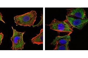 Immunofluorescence analysis of U251 (left) and NTERA2 (right) cells using CRTC1 antibody (green). (CRTC1 antibody)