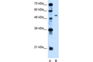 Western Blotting (WB) image for anti-Pregnancy Specific beta-1-Glycoprotein 1 (PSG1) antibody (ABIN2462566)