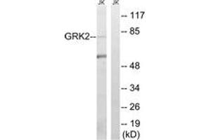 Western blot analysis of extracts from Jurkat cells, using GRK2 (Ab-685) Antibody. (GRK2 antibody  (AA 640-689))