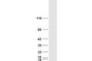WD Repeat Domain 46 (WDR46) protein (Myc-DYKDDDDK Tag)