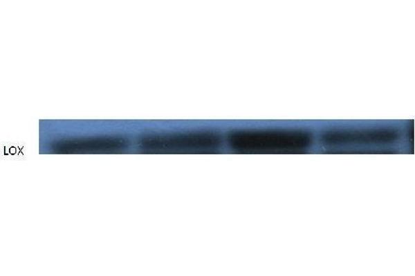 OLR1 antibody  (AA 201-273)