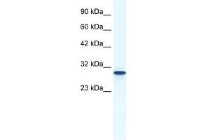 Annexin A5 antibody used at 1.