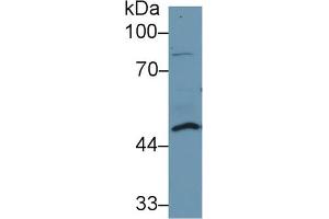 Western Blot; Sample: Human Lung lysate; ;Primary Ab: 1µg/ml Rabbit Anti-Human DDOST Antibody;Second Ab: 0. (DDOST antibody  (AA 43-427))