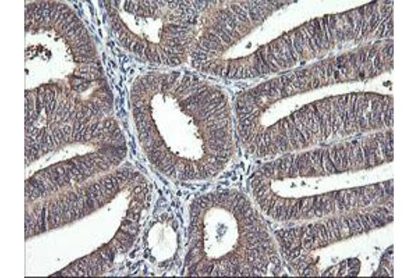 IL1F9 antibody