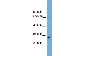 WB Suggested Anti-ZNF37A Antibody Titration:  0. (ZNF37A antibody  (Middle Region))