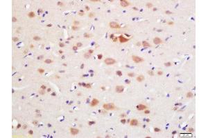 Formalin-fixed and paraffin embedded rat brain labeled with Rabbit Anti-DAL1 Polyclonal Antibody, Unconjugated (ABIN761021) at 1:200 followed by conjugation to the secondary antibody and DAB staining (EPB41L3 antibody)