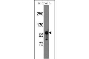 Western blot analysis of mouse anti-Semaphorin 5A Pab (ABIN389166 and ABIN2839332) in mouse brain tissue lysates (35 μg/lane). (SEMA5A antibody  (AA 1006-1035))