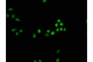 Immunofluorescence staining of Hela cells with ABIN7160246 at 1:33, counter-stained with DAPI. (SMAD7 antibody  (AA 36-247))