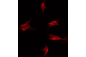 ABIN6274495 staining HuvEc by IF/ICC. (NADAP antibody  (C-Term))