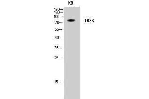 Western Blotting (WB) image for anti-T-Box 3 (TBX3) (Internal Region) antibody (ABIN3187197) (TBX3 antibody  (Internal Region))