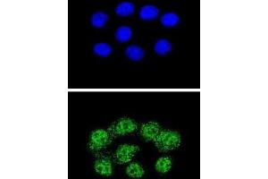Immunofluorescence (IF) image for anti-Mismatch Repair Protein 2 (MSH2) antibody (ABIN2996263) (MSH2 antibody)