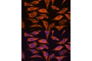 Immunofluorescence analysis of L929 cells using MRPS14 antibody (ABIN7270013) at dilution of 1:100. (RPS14 antibody  (AA 1-128))