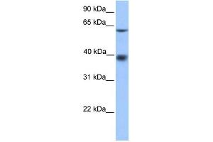 MFSD4 antibody used at 1 ug/ml to detect target protein. (MFSD4 antibody  (N-Term))