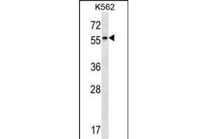 RARB Antibody (Center) (ABIN1537931 and ABIN2849656) western blot analysis in K562 cell line lysates (35 μg/lane). (Retinoic Acid Receptor beta antibody  (AA 168-195))
