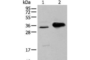 Western blot analysis of TM4 cell and Mouse brain tissue using ATP6V1E2 Polyclonal Antibody at dilution of 1:400 (ATP6V1E2 antibody)