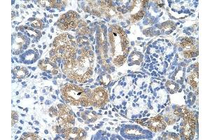 Cobl-Like 1 antibody was used for immunohistochemistry at a concentration of 4-8 ug/ml to stain Epithelial cells of renal tubule (arrows) in Human Kidney.
