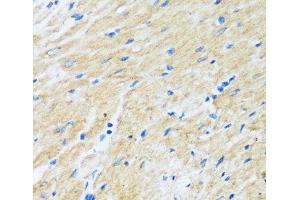 Immunohistochemistry of paraffin-embedded Rat heart using BAG3 Polyclonal Antibody at dilution of 1:100 (40x lens). (BAG3 antibody)