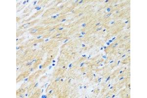 Immunohistochemistry of paraffin-embedded Rat heart using BAG3 Polyclonal Antibody at dilution of 1:100 (40x lens).