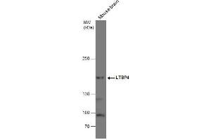 WB Image LTBP4 antibody detects LTBP4 protein by western blot analysis. (LTBP4 antibody  (N-Term))