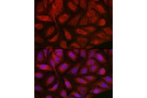 Immunofluorescence analysis of U2OS cells using Endothelin 1 Rabbit pAb (ABIN3021075, ABIN3021076, ABIN3021077 and ABIN6213940) at dilution of 1:50 (40x lens). (Endothelin 1 antibody  (AA 18-212))