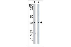 The anti-PDXK Pab (ABIN391110 and ABIN2841241) is used in Western blot to detect PDXK in mouse intestine tissue lysate (Lane 1) and Hela cell lysate (Lane 2). (PDXK antibody  (N-Term))
