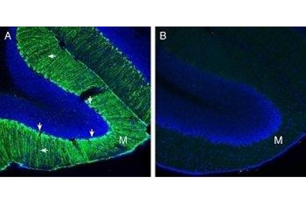 SCTR antibody  (Extracellular, N-Term)