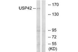 Western blot analysis of extracts from HT-29 cells, using USP42 Antibody. (USP42 antibody  (AA 251-300))