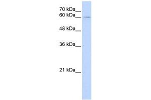 IL22R alpha 1 antibody used at 1 ug/ml to detect target protein. (IL22 Receptor alpha 1 antibody  (Middle Region))