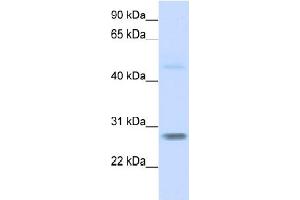 WB Suggested Anti-FBXO25  Antibody Titration: 0. (FBXO25 antibody  (N-Term))