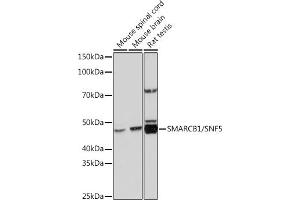 Western blot analysis of extracts of various cell lines, using SM/SNF5 Rabbit mAb (ABIN7270657) at 1:1000 dilution. (SMARCB1 antibody)