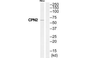Western Blotting (WB) image for anti-Carboxypeptidase N Subunit 2 (CPN2) (C-Term) antibody (ABIN1851028) (CPN2 antibody  (C-Term))