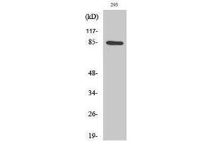 Western Blotting (WB) image for anti-conserved Helix-Loop-Helix Ubiquitous Kinase (CHUK) (Ser249) antibody (ABIN3185147)