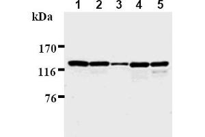 Western Blotting (WB) image for anti-Polymerase (DNA Directed), delta 1, Catalytic Subunit 125kDa (POLD1) antibody (ABIN567776)
