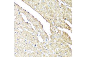 Immunohistochemistry (IHC) image for anti-Interferon alpha/beta Receptor 2 (IFNAR2) (AA 27-243) antibody (ABIN3015563)
