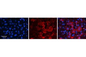 Rabbit Anti-ZNF142 Antibody  Catalog Number: ARP38554_P050 Formalin Fixed Paraffin Embedded Tissue: Human Adult Liver  Observed Staining: Cytoplasm, Membrane in hepatocytes, strong signal, low tissue distribution Primary Antibody Concentration: 1:100 Secondary Antibody: Donkey anti-Rabbit-Cy3 Secondary Antibody Concentration: 1:200 Magnification: 20X Exposure Time: 0. (ZNF142 antibody  (C-Term))