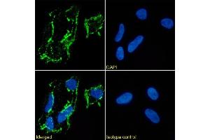 Immunofluorescence staining of Kelly cells using anti-CD56. (Recombinant CD56 antibody)