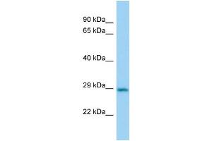 Host:  Rabbit  Target Name:  Cbr2  Sample Type:  Mouse Lung lysates  Antibody Dilution:  1. (CBR2 antibody  (N-Term))