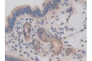 Detection of BMP15 in Mouse Uterus Tissue using Polyclonal Antibody to Bone Morphogenetic Protein 15 (BMP15)