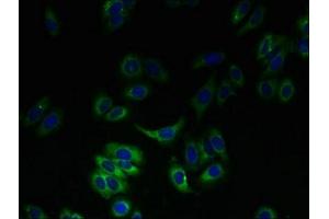 Immunofluorescent analysis of HepG2 cells using ABIN7170179 at dilution of 1:100 and Alexa Fluor 488-congugated AffiniPure Goat Anti-Rabbit IgG(H+L) (SLC23A3 antibody  (AA 391-492))