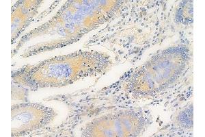 ABIN6264912 and ABIN6269293 at 1/100 staining human normal colon tissue by IHC-P. (RPS6 antibody  (C-Term))