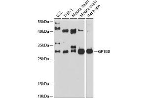 Western blot analysis of extracts of various cell lines, using GP1BB antibody (ABIN6132055, ABIN6141287, ABIN6141288 and ABIN6214244) at 1:1000 dilution. (GP1BB antibody  (AA 27-147))