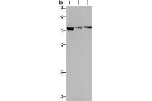 Gel: 8 % SDS-PAGE, Lysate: 40 μg, Lane 1-3: Hela cells, SKOV3 cells, Jurkat cells, Primary antibody: ABIN7130010(KLHL9 Antibody) at dilution 1/300, Secondary antibody: Goat anti rabbit IgG at 1/8000 dilution, Exposure time: 1 minute (KLHL9 antibody)
