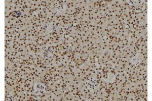 ABIN6264703 and ABIN6269101 at 1/100 staining Rat kidney tissue by IHC-P. (Retinoblastoma Protein (Rb) antibody  (C-Term))