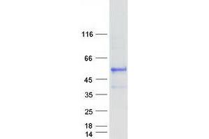 Validation with Western Blot