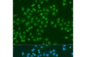Immunofluorescence analysis of U2OS cells using MSI1 Polyclonal Antibody at dilution of 1:100. (MSI1 antibody)